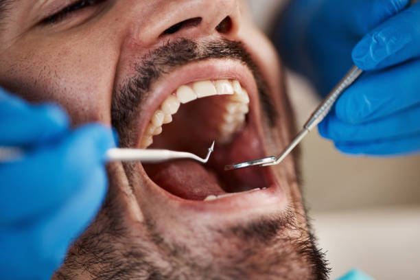 Best Pediatric Emergency Dentist in East Porterville, CA