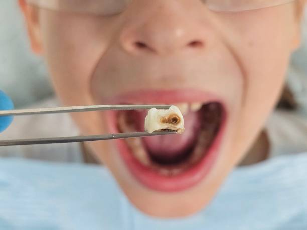 Best Emergency Dental Surgery in East Porterville, CA