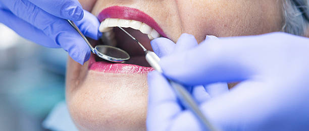 Best Emergency Broken Tooth Repair in East Porterville, CA